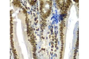 Immunohistochemistry of paraffin-embedded Mouse Intestine using SF3B2 Polyclonal Antibody at dilution of 1:100 (40x lens). (SF3B2 Antikörper)