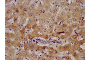 IHC image of ABIN7143624 diluted at 1:700 and staining in paraffin-embedded human liver tissue performed on a Leica BondTM system. (AGXT2 Antikörper  (AA 196-328))