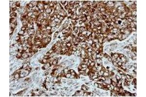 Immunohistochemistry: PPP3CB antibody staining of Paraffin-Embedded H661 Xenograft at 1/500 dilution. (PPP3CB Antikörper)