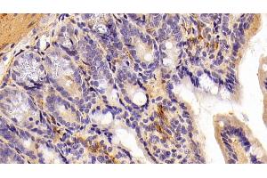 Immunohistochemistry (IHC) image for anti-Adiponectin Receptor 2 (ADIPOR2) (AA 1-147) antibody (ABIN7431158)