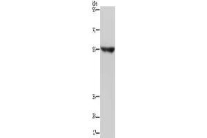 Gel: 6 % SDS-PAGE, Lysate: 40 μg, Lane: Human fetal brain tissue, Primary antibody: ABIN7191717(NRG3 Antibody) at dilution 1/200, Secondary antibody: Goat anti rabbit IgG at 1/8000 dilution, Exposure time: 2 minutes (Neuregulin 3 Antikörper)