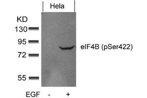 Western blot analysis of extracts from Hela cells untreated or treated with EGF using eIF4B(phospho-Ser422) Antibody. (EIF4B Antikörper  (pSer422))