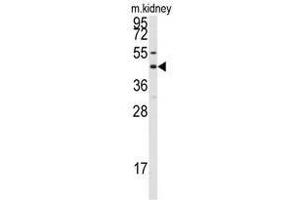 Image no. 1 for anti-Gap Junction Protein, alpha 8, 50kDa (GJA8) (C-Term) antibody (ABIN357099) (GJA8 Antikörper  (C-Term))