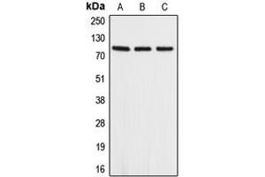 Western blot analysis of APLP2 expression in A549 (A), mouse heart (B), rat heart (C) whole cell lysates. (APLP2 Antikörper  (Center))