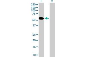 Western Blot analysis of ABLIM1 expression in transfected 293T cell line by ABLIM1 MaxPab polyclonal antibody. (ABLIM1 Antikörper  (AA 1-401))