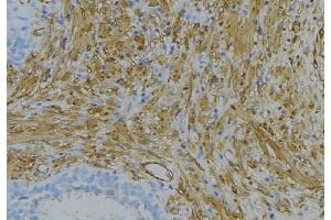 Immunohistochemistry (IHC) image for anti-Collagen, Type VI, alpha 2 (COL6A2) (Internal Region) antibody (ABIN6257110)