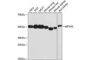 Western blot analysis of extracts of various cell lines, using eEF1 Rabbit mAb (1545) at 1:1000 dilution. (eEF1A1 Antikörper)