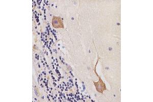 (ABIN6244287 and ABIN6577245) staining CK2 in human cerebellum tissue sections by Immunohistochemistry (IHC-P - paraformaldehyde-fixed, paraffin-embedded sections). (CAMK2B Antikörper  (AA 1-503))