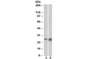 Western blot testing of human kidney [A] and liver [B] lysate with APOD antibody at 0. (Apolipoprotein D Antikörper)
