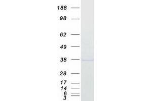 Validation with Western Blot (MTHFD2 Protein (Myc-DYKDDDDK Tag))