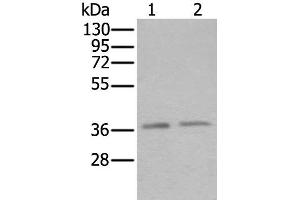 Western blot analysis of Hela and Raji cell lysates using ATXN7L3 Polyclonal Antibody at dilution of 1:500 (ATXN7L3 Antikörper)