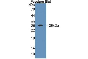 Western blot analysis of the recombinant protein. (IL27 Receptor alpha Antikörper  (AA 93-273))
