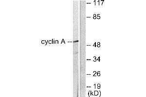 Western blot analysis of extracts from COS7 cells, using Cyclin A antibody (#C0165). (Cyclin A Antikörper)
