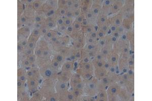Used in DAB staining on fromalin fixed paraffin- embedded liver tissue (AVPI1 Antikörper)