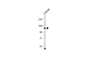 Anti-ATP1A4 Antibody (N-Term) at 1:2000 dilution + Human brain lysate Lysates/proteins at 20 μg per lane. (ATP1A4 Antikörper  (AA 12-46))