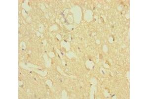 Immunohistochemistry of paraffin-embedded human brain tissue using ABIN7176279 at dilution of 1:100 (ZNF396 Antikörper  (AA 1-200))