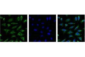 Immunofluorescence (IF) image for anti-Aquaporin 4 (AQP4) antibody (ABIN7189135)