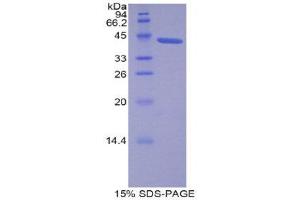 SDS-PAGE (SDS) image for Lipocalin 12 (LCN12) (AA 61-184) protein (His tag,GST tag) (ABIN1877953)