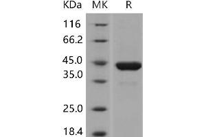 Phosphoglycerate Kinase 1 (PGK1) protein (His tag)