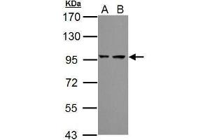 WB Image Sample (30 ug of whole cell lysate) A: JC B: BCL-1 7. (PSMD2 Antikörper)