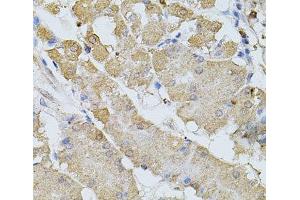 Immunohistochemistry of paraffin-embedded Human stomach using BEST1 Polyclonal Antibody at dilution of 1:100 (40x lens). (Bestrophin 1 Antikörper)