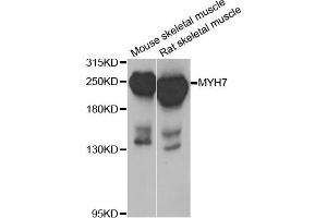 Western blot analysis of extracts of mouse skeletal muscle and rat skeletal muscle cell lines, using MYH7 antibody. (MYH7 Antikörper)