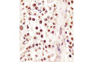 (ABIN6244063 and ABIN6578228) staining RBMX in human testis tissue sections by Immunohistochemistry (IHC-P - paraformaldehyde-fixed, paraffin-embedded sections). (RBMX Antikörper  (AA 262-294))