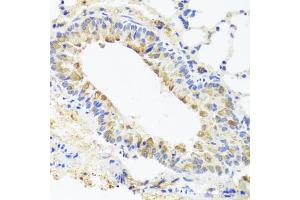 Immunohistochemistry of paraffin-embedded mouse lung using BGLAP antibody (ABIN5975009) at dilution of 1/100 (40x lens). (Osteocalcin Antikörper)