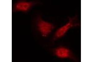 Immunofluorescence (fixed cells) (IF/ICC) image for anti-LIM Domain Kinase 2 (LIMK2) (pSer283) antibody (ABIN6256239)