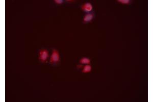 ABIN6274217 staining HeLa cells by ICC/IF. (APEX1 Antikörper  (N-Term))