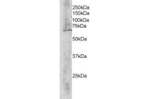 ABIN184688 staining (4 ug/ml) of Human Brain lysate (RIPA buffer, 35 ug total protein per lane). (TBL1X Antikörper  (C-Term))