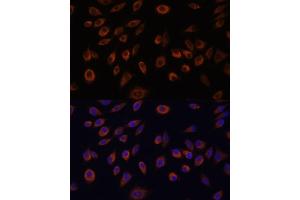 Immunofluorescence analysis of L929 cells using NTPCR antibody (ABIN7269059) at dilution of 1:100. (C1orf57 Antikörper  (AA 91-190))
