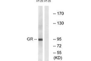 Western blot analysis of extracts from HT-29 cells, treated with PMA 125ng/ml 30', using GR (Ab-211) Antibody. (GR (AA 181-230) Antikörper)