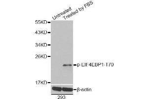 Western blot analysis of extracts of 293 cells, using Phospho-EIF4EBP1-T70 antibody. (eIF4EBP1 Antikörper  (pThr70))