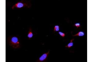 IF analysis of DARS2 using anti-DARS2 antibody (ABIN6719279). (DARS2 Antikörper  (AA 334-448))
