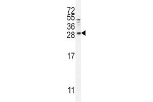 Western Blotting (WB) image for anti-Betacellulin (BTC) antibody (ABIN2996306) (Betacellulin Antikörper)