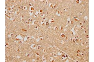 IHC image of ABIN7154933 diluted at 1:200 and staining in paraffin-embedded human brain tissue performed on a Leica BondTM system. (HHIP Antikörper  (AA 183-424))