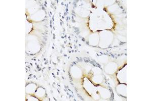 Immunohistochemistry of paraffin-embedded human colon using CCL22 antibody (ABIN5974972) at dilution of 1/100 (40x lens).
