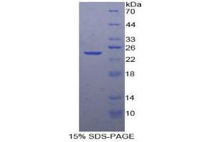 SDS-PAGE analysis of Human Smad3 Protein. (SMAD3 Protein)
