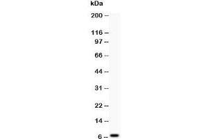 Western blot testing of Defensin 1 antibody at and COLO320 lysate;  Predicted size: 7KD;  Observed size: 7KD (beta Defensin 1 Antikörper  (C-Term))