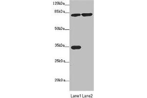 Western blot All lanes: MTO1 antibody at 4. (MTO1 Antikörper  (AA 420-680))