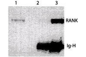 Image no. 1 for anti-Tumor Necrosis Factor Receptor Superfamily, Member 11a, NFKB Activator (TNFRSF11A) (Extracellular Domain) antibody (ABIN208201) (TNFRSF11A Antikörper  (Extracellular Domain))