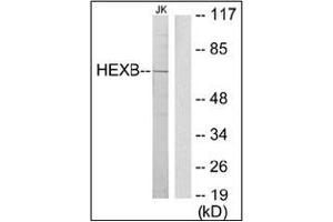 Western blot analysis of extracts from Jurkat cells using HEXB Antibody . (HEXB Antikörper  (C-Term))