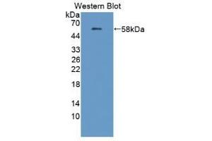 Detection of Recombinant APBB1IP, Human using Polyclonal Antibody to Amyloid Beta Precursor Protein Binding B1 Interacting Protein (APBB1IP) (Amyloid beta (A4) Precursor Protein-Binding, Family B, Member 1 Interacting Protein (APBB1IP) (AA 188-421) Antikörper)