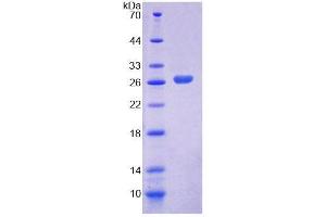 SDS-PAGE analysis of Human LRP1B Protein. (LRP1B Protein)