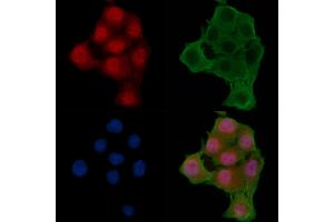 ABIN6256090 and ABIN6267276 staining Hela cells(24h of starvation treatment) by IF/ICC. (Estrogen Receptor alpha Antikörper  (pSer104))