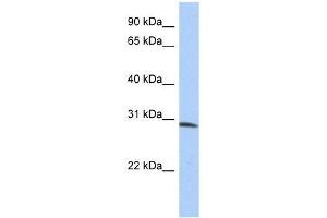 ZFYVE28 antibody used at 0. (ZFYVE28 Antikörper  (N-Term))