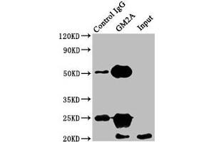 Immunoprecipitating GM2A in HEK293 whole cell lysate Lane 1: Rabbit control IgG instead of ABIN7153574 in HEK293 whole cell lysate. (GM2A Antikörper  (AA 32-193))