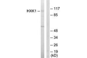 Western blot analysis of extracts from HeLa cells, using HXK1 Antibody. (Hexokinase 1 Antikörper  (AA 31-80))