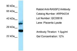 Western Blotting (WB) image for anti-Ras Association (RalGDS/AF-6) Domain Family Member 2 (RASSF2) (C-Term) antibody (ABIN2789773) (RASSF2 Antikörper  (C-Term))